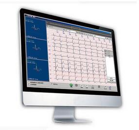 動態(tài)心電圖分析系統(tǒng) Cardio 8000