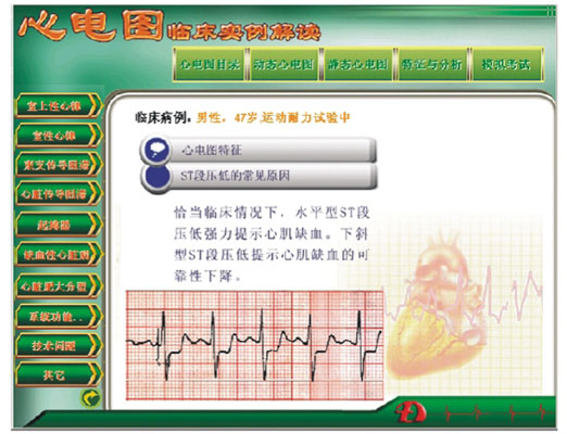 新版心電圖教學(xué)軟件 心電圖臨床實(shí)例解讀KAS/XDR
