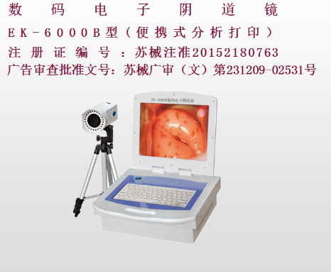 億康盈聯(lián)數(shù)碼電子陰道鏡EK-6000B（彩色液晶分析打印）