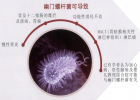 幽門螺桿菌檢測原理：13C尿素呼氣檢測的優(yōu)點與應(yīng)用