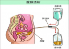 家用透析機(jī)代理：專業(yè)團(tuán)隊(duì)，完善的服務(wù)，讓您安心