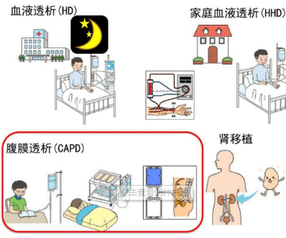 家用透析機(jī)