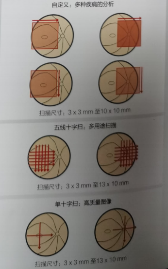 相干斷層掃描儀2.png