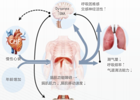 體外隔肌起搏器