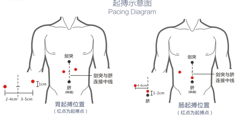 胃腸動力治療儀