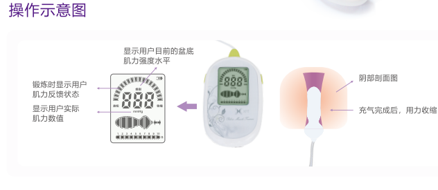 盆底康復(fù)