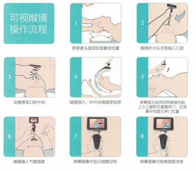 可視喉鏡
