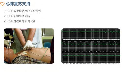 除顫監(jiān)護儀