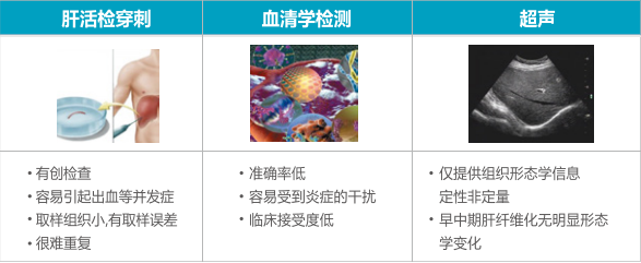 無創(chuàng)肝纖維化檢測系統(tǒng)1