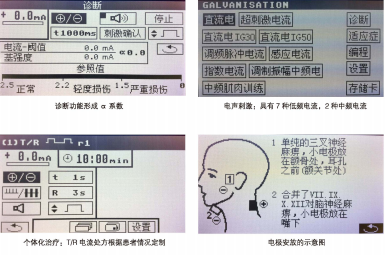 吞咽言語(yǔ)障礙
