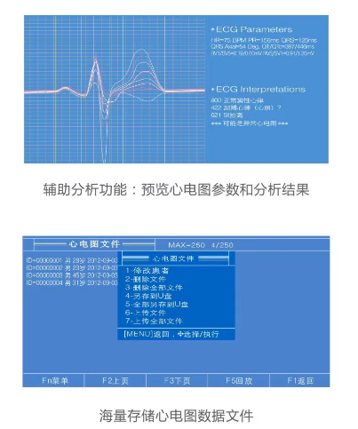 aricon心電圖機