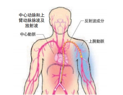 動脈硬化原理