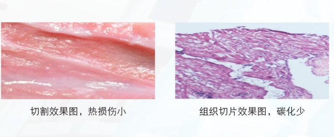 雙極等離子高頻手術(shù)設(shè)備