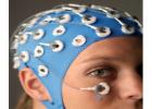 EEG-fMRI: 腦功能評估的重要交叉技術