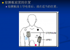 除顫儀電極放置及注意事項(xiàng)