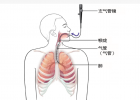詳細(xì)介紹支氣管鏡的操作流程和清除效果