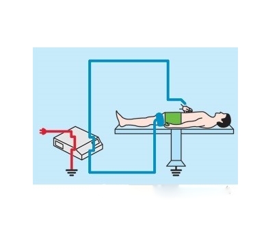 高頻電刀使用流程.png