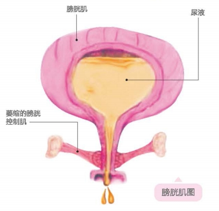 盆底肌康復(fù)治療儀