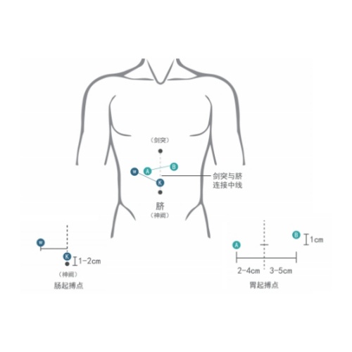 胃腸電圖
