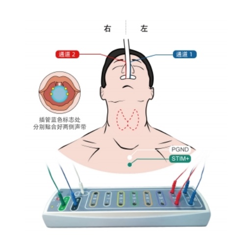 術(shù)中喉反神經(jīng)