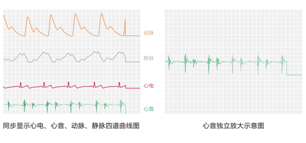 血流分析儀