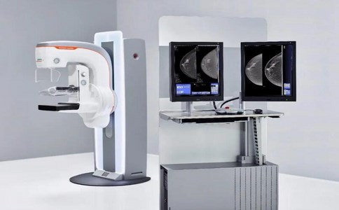 乳腺X光機(jī) 乳腺X光機(jī)