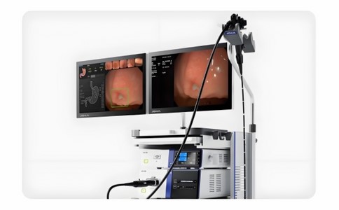 澳華內(nèi)鏡鼻咽喉鏡 澳華內(nèi)鏡鼻咽喉鏡