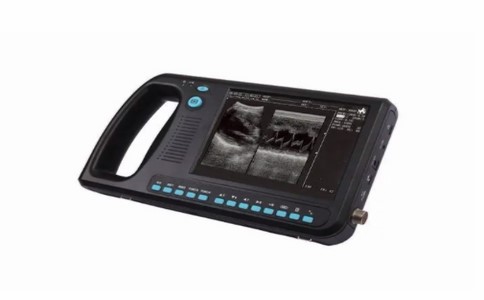 掌上超聲診斷儀 掌上超聲診斷儀
