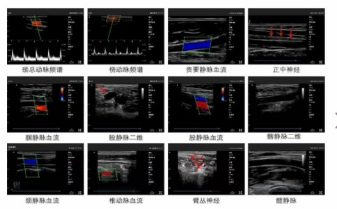 思多科掌上超聲診斷儀.jpg 思多科掌上超聲診斷儀.jpg