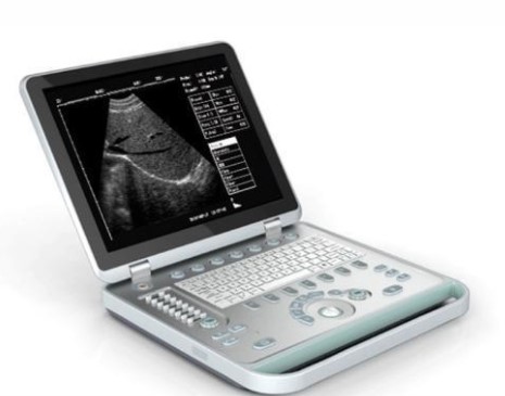 索諾星掌上超聲診斷儀 索諾星掌上超聲診斷儀