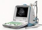 便攜式黑白b超機價格|涵飛醫(yī)療