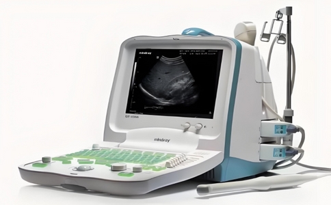 便攜式黑白b超機 便攜式黑白b超機