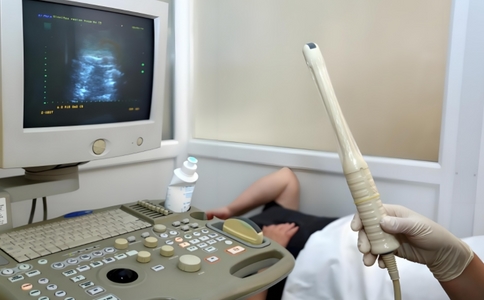 陰道超聲.jpg 陰道超聲.jpg