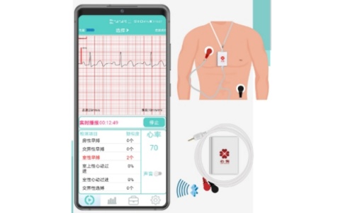 心狗動(dòng)態(tài)心電圖系統(tǒng)HWD系列