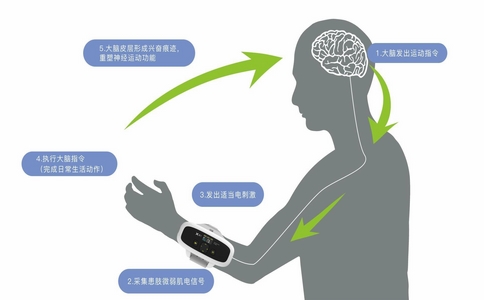 2025-02-14_神經(jīng)康復(fù)治療儀_5.jpg